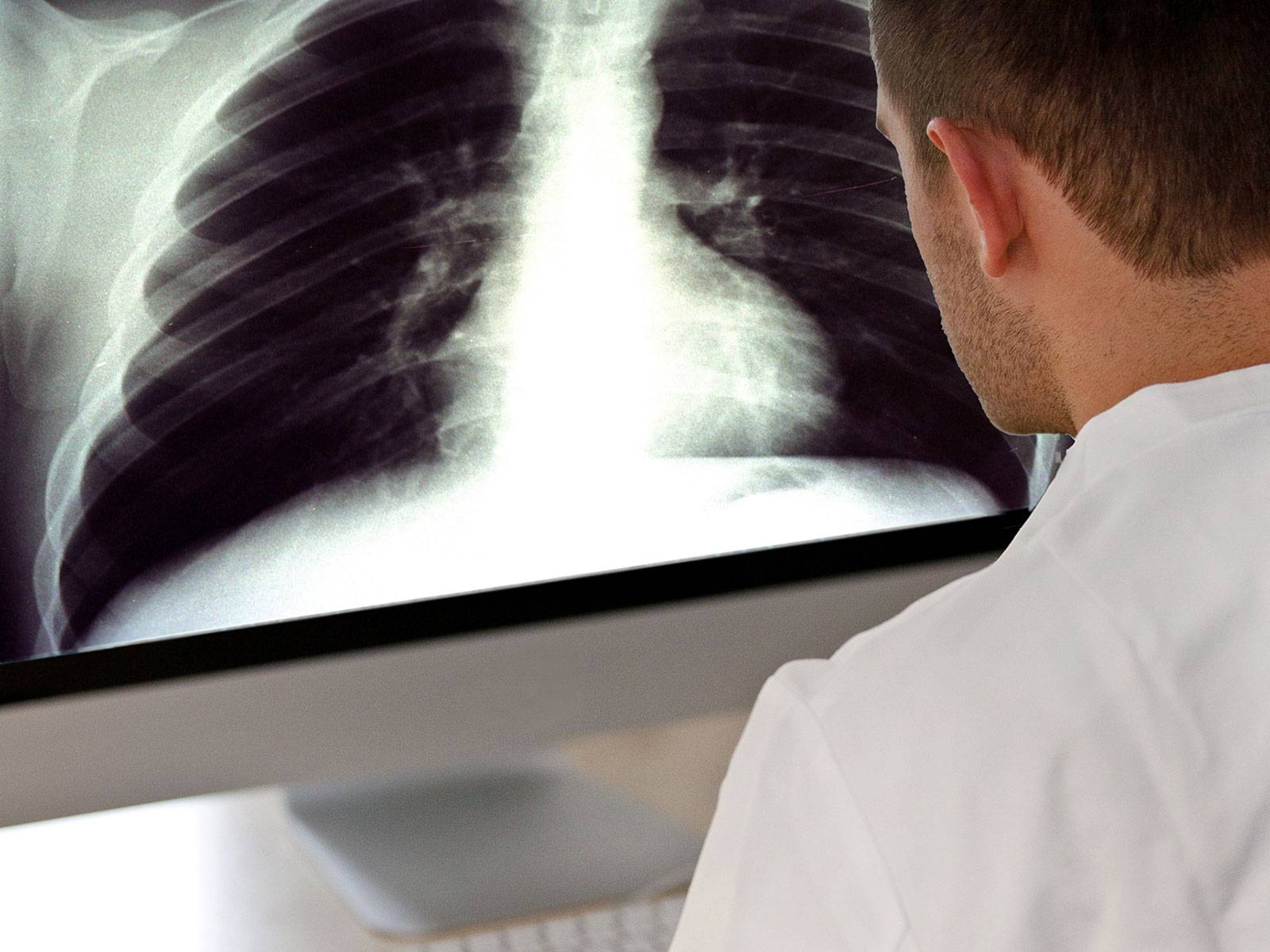 Mann vor Röntgenaufnahme auf Bildschirm.